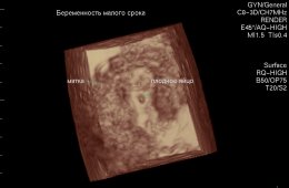 Правильно рассчитать срок беременности